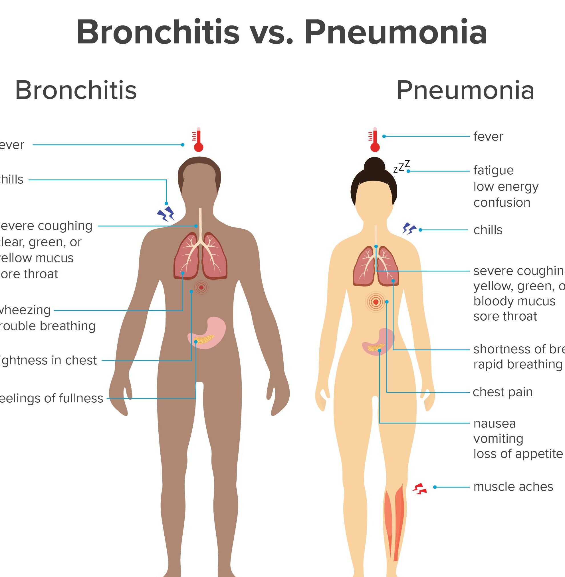 Bronquitis aguda Información |